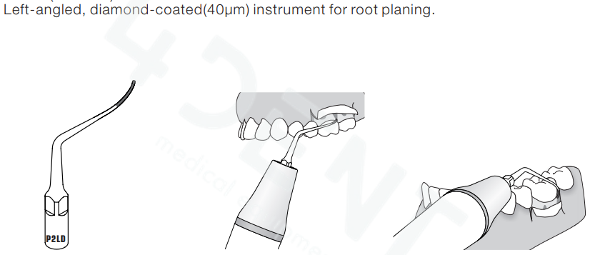 P2LDb.png