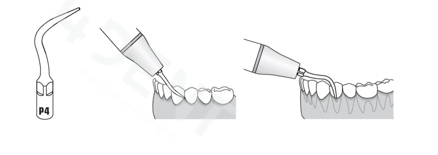 P4b.jpg